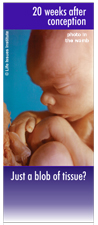 Banner - Just a blob?