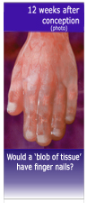 Banner - Would a blob have finger nails?