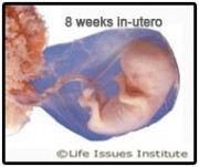 Gestational limits do not restrict abortions