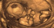 Baby at centre of Roe v. Wade breaks silence, describes heartache of being born ‘unwanted’ 