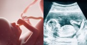Big pro-life win in St. Catharines