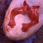 abortion photos