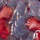 abortion photos