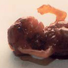 abortion photos