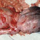 abortion photos